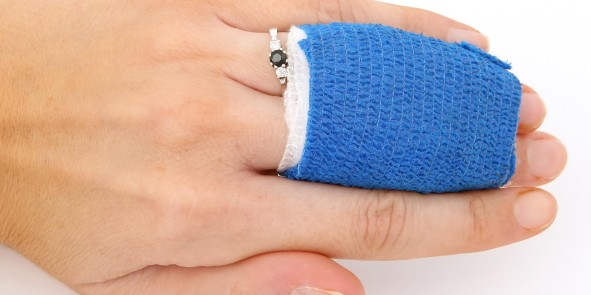 Hand mit zwei verbundenen Fingern