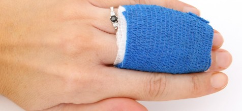 Hand mit zwei verbundenen Fingern
